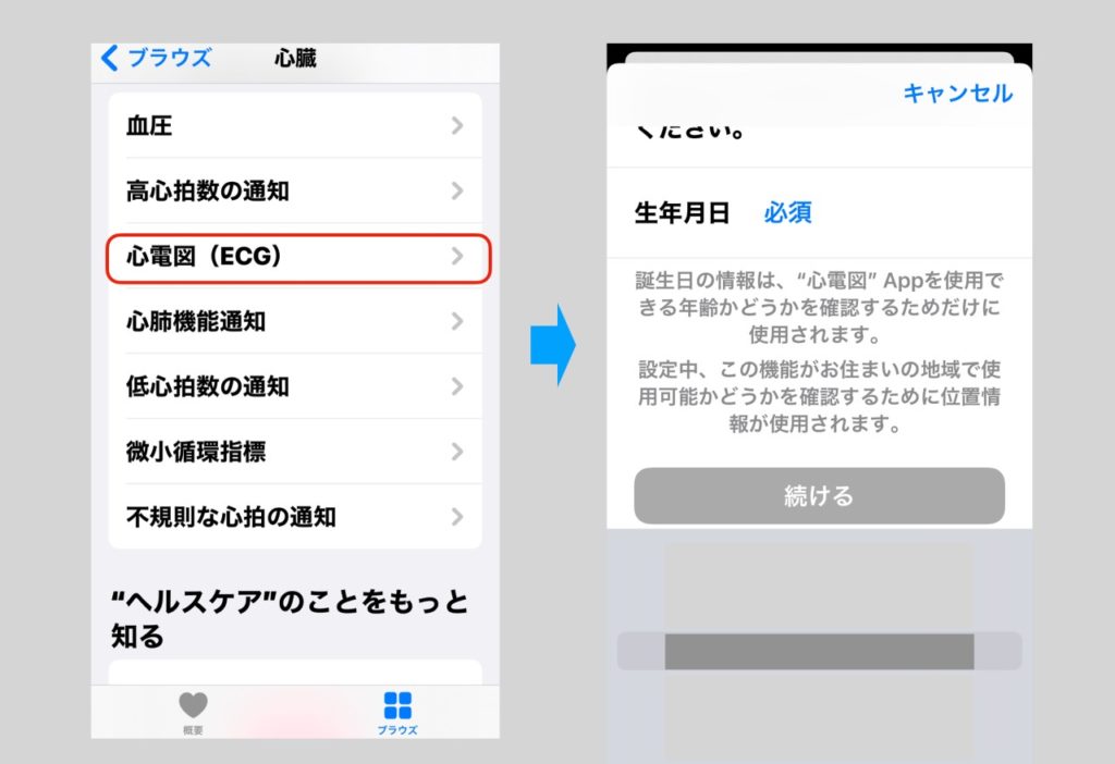 Apple Watchの日本で有効化された心電図機能の設定方法
